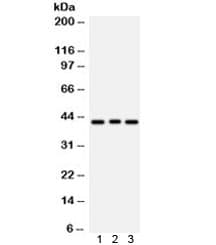 Polyclonal Rabbit anti-Human ATXN3 / JOS Antibody (IHC, WB)
