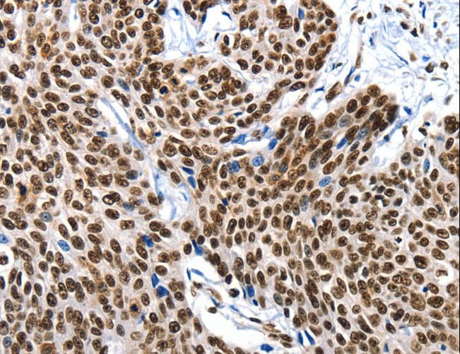 KLK7 / Kallikrein 7 Antibody