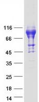Human IL6R / IL6 Receptor Protein (Recombinant Myc-DDK (Flag))
