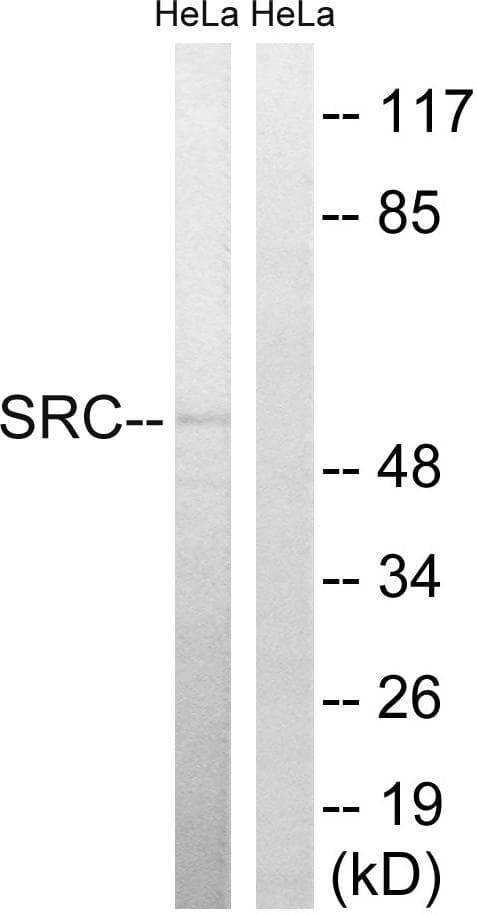 Polyclonal Rabbit anti-Human SRC Antibody (p75, IHC, WB)