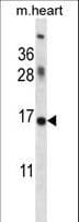 ID / ID1 Antibody (aa66-93)