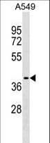 ZCCHC12 Antibody (aa374-402)