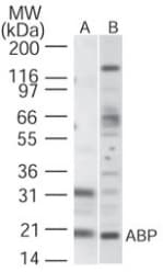 KCNIP1 / KCHIP1 Antibody (aa11-28)