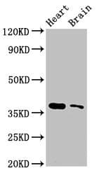 SRR / Serine Racemase Antibody