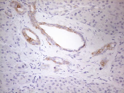 ERBB3 / HER3 Antibody (aa983-1342, clone OTI3C1)