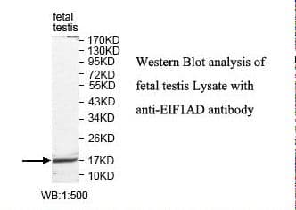 EIF1AD Antibody (aa1-165)