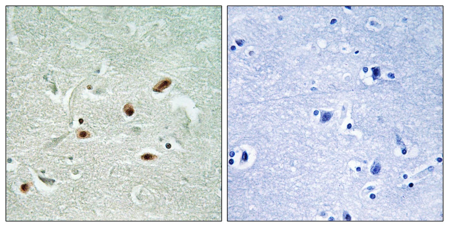Polyclonal Rabbit anti-Human PRKDC / DNA-PKcs Antibody (phospho-Ser2612, IHC)