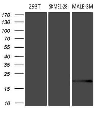 MLANA / Melan-A Antibody (aa48-118, clone OTI2E7)