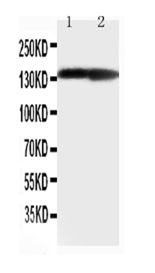 COL2A1 / Collagen II Alpha 1 Antibody (aa1222-1241)