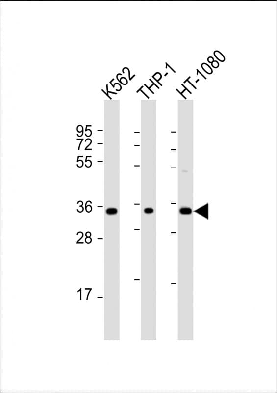 TMEM158 / RIS1 Antibody (aa186-218)