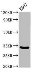 Polyclonal Rabbit anti-Human PEX26 Antibody (IHC, WB)