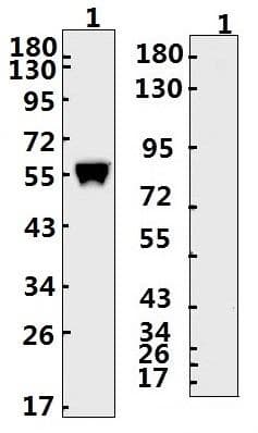 SARS-CoV-2 Nucleoprotein Antibody