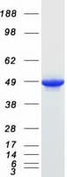 Human PME-1 / PPME1 Protein (Recombinant Myc-DDK (Flag))