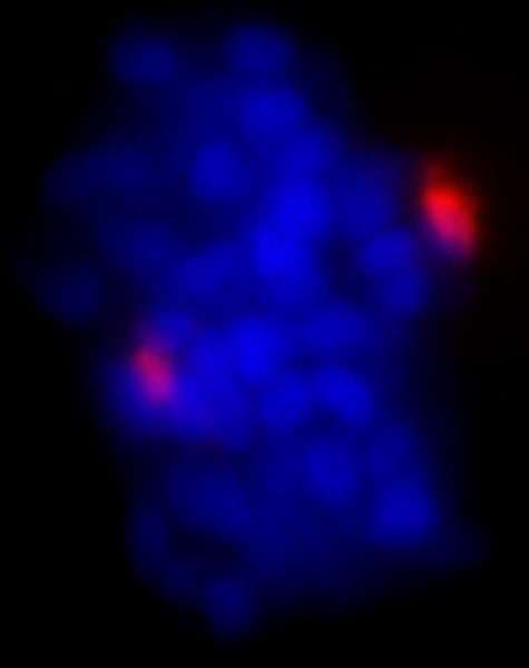 Polyclonal Rabbit anti-Human PCNT / Pericentrin Antibody (aa175-225, IF)