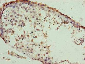 SLC26A8 / TAT1 Antibody
