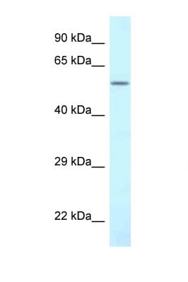 Polyclonal Rabbit anti-Human CTP Synthetase 2 / CTPS2 Antibody (aa170-219, WB)