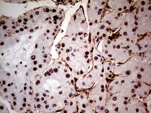 NSD3 / WHSC1L1 Antibody (aa427-566, clone OTI3B3, Carrier-free)