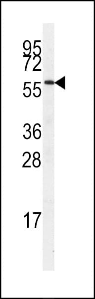 SRPK3 / MSSK1 Antibody (aa285-315)