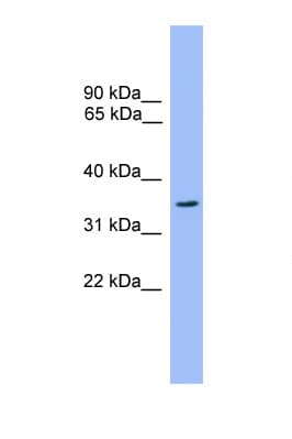 Polyclonal Rabbit anti-Human OR2C3 Antibody (aa251-300, WB)