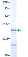Human LHX3 Protein (Recombinant GST, N-terminus)