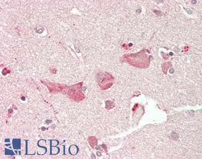 IHC-plus™ Polyclonal Rabbit anti-Human MYCN / N-myc Antibody (aa322-351, IHC, WB)