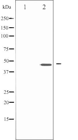 Polyclonal Rabbit anti-Human IKBKG / NEMO / IKK Gamma Antibody (phospho-Ser85, IF, WB)
