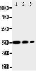 CD163 Antibody (aa1056-1165)
