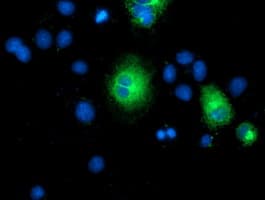 Monoclonal Mouse anti-Human TMEM80 Antibody (clone OTI3B6, IF, WB)