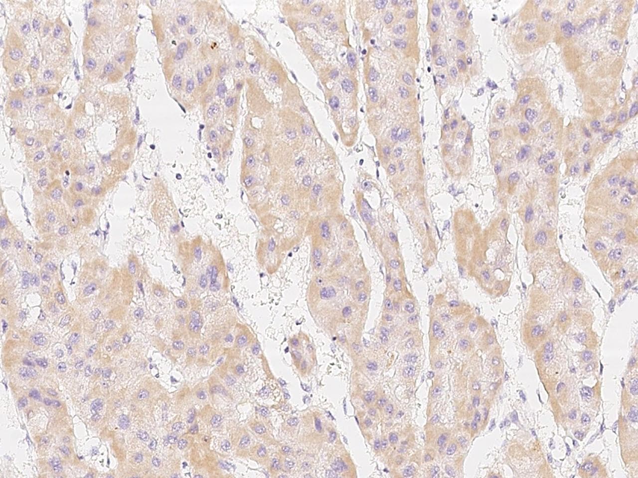 Polyclonal Rabbit anti-Human MSRB2 / MSRB Antibody (IHC)