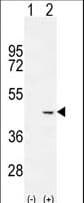 Cochlin / COCH Antibody (aa492-520)