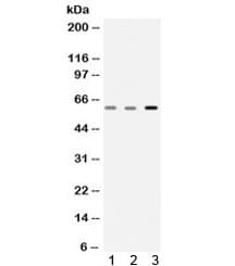 Polyclonal Rabbit anti-Human CAT / Catalase Antibody (IHC, WB)