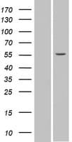 SPATA6 / SRF-1 Protein (Over-Expression Lysate Myc-DDK (Flag))
