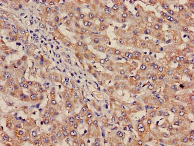 Polyclonal Rabbit anti-Human ITGA2B / CD41 Antibody (aa639-887)