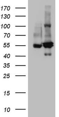 SHMT / SHMT2 Antibody (clone OTI3B3)