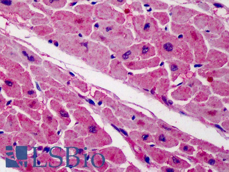 IHC-plus™ ZBTB7A / Pokemon Antibody (C-Terminus)
