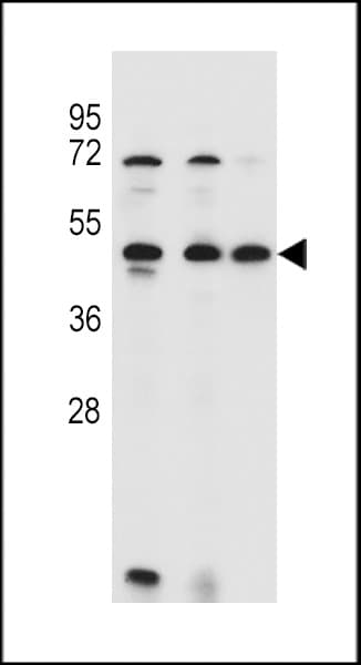 ANKRD40 Antibody (aa256-284)