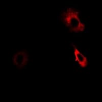 AKR7A2 / AFAR Antibody