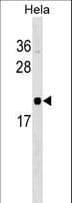 RWDD1 Antibody (aa38-65)