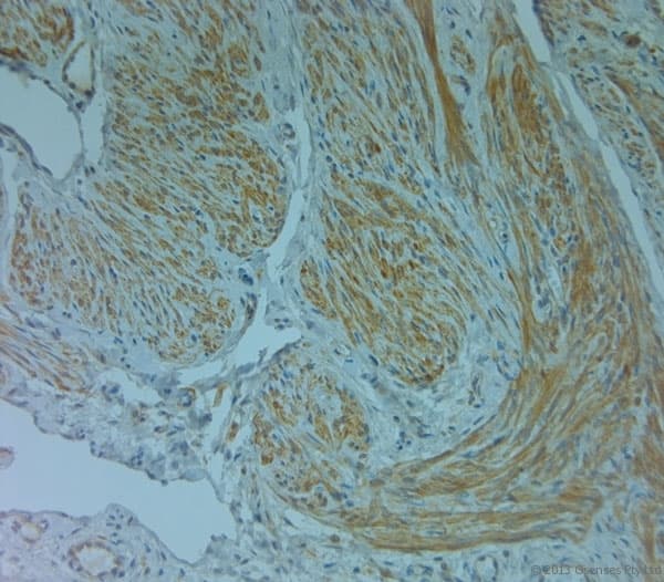PLIN4 / S3-12 Antibody (aa1050-1100)