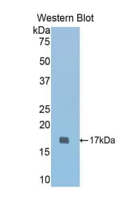 COMP / THBS5 Antibody (aa317-455)