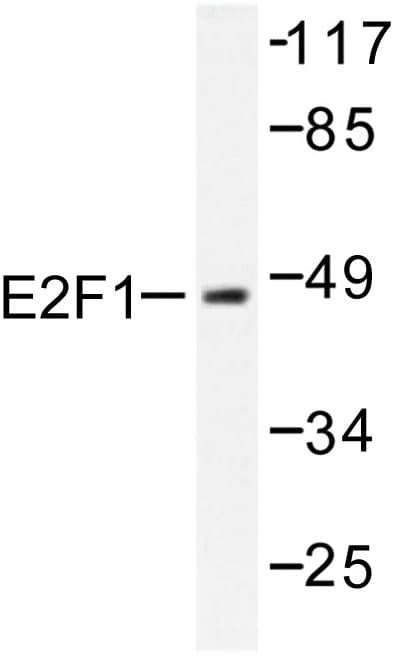 E2F1 Antibody (Asp426)