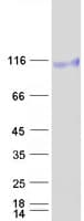 Human EPHB4 / EPH Receptor B4 Protein (Recombinant Myc-DDK (Flag))