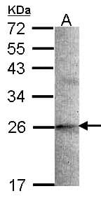 SCG10 / STMN2 Antibody (aa2-41)