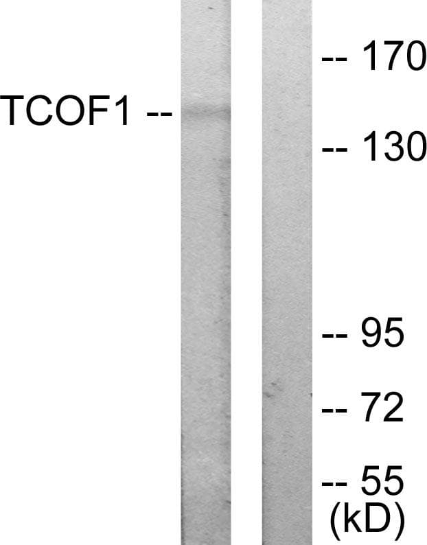 Treacle / TCOF1 Antibody
