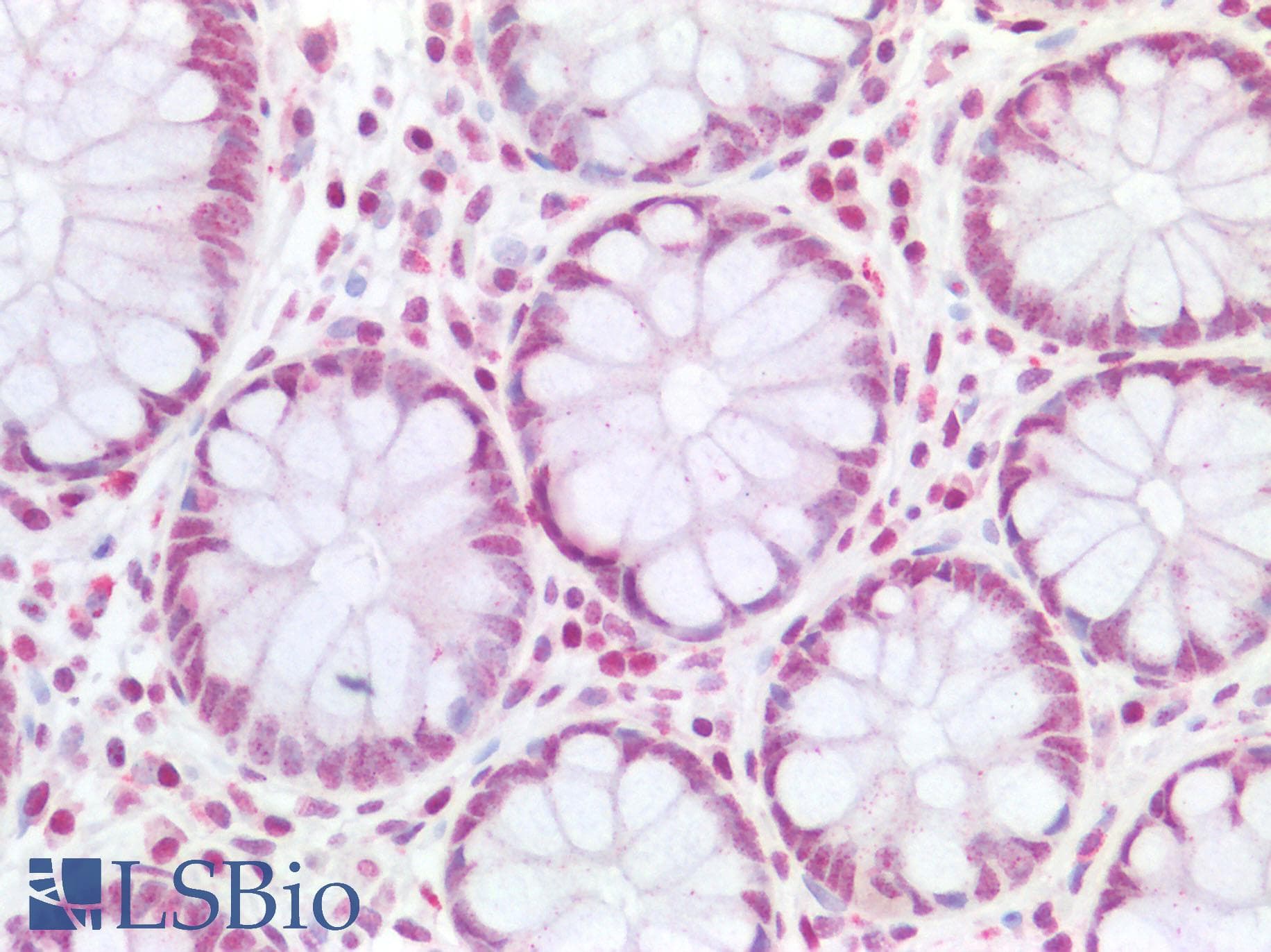 Monoclonal Mouse anti-Human HOXA9 Antibody (clone 2A11-2D2, IHC, IF, WB)
