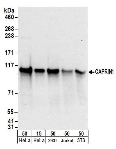 PSMD4 / RPN10 Antibody (aa327-377)