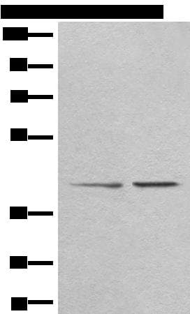 TMEM248 / c7orf42 Antibody