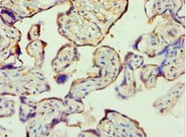 Polyclonal Rabbit anti-Human PPP3CC / CALNA3 Antibody (aa373-512, IHC, WB)