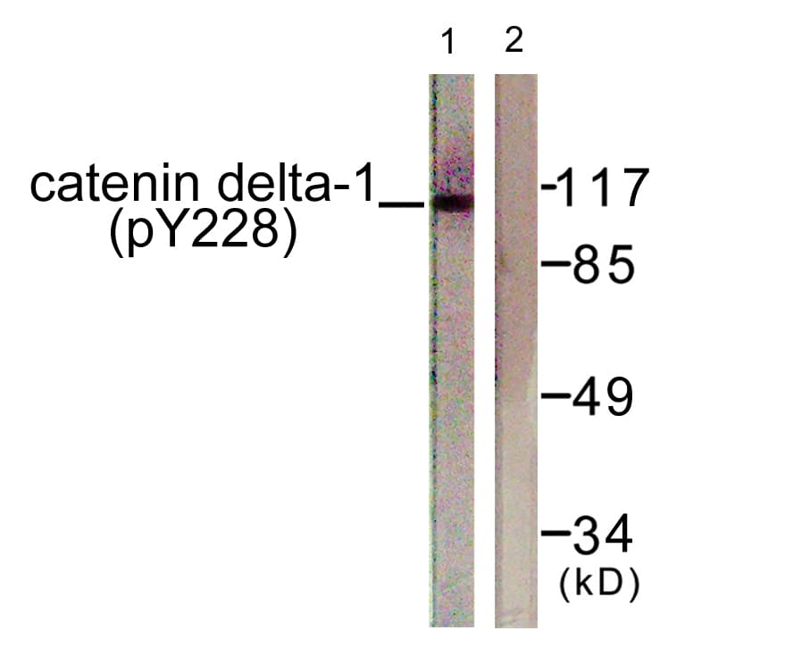 CTNND1 / p120 Catenin Antibody (phospho-Tyr228)