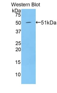 THBS2 / Thrombospondin 2 Antibody (aa968-1170, HRP)